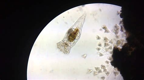  Vorticella! Ein faszinierendes Radtier mit winzigen Härchen für die Nahrungsaufnahme